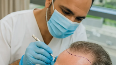 Is a Hair Transplant in Dubai Your Path to Fuller Hair?