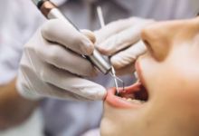 Modern Techniques That Are Revolutionising Endodontist Services