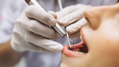 Modern Techniques That Are Revolutionising Endodontist Services