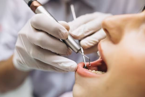 Modern Techniques That Are Revolutionising Endodontist Services